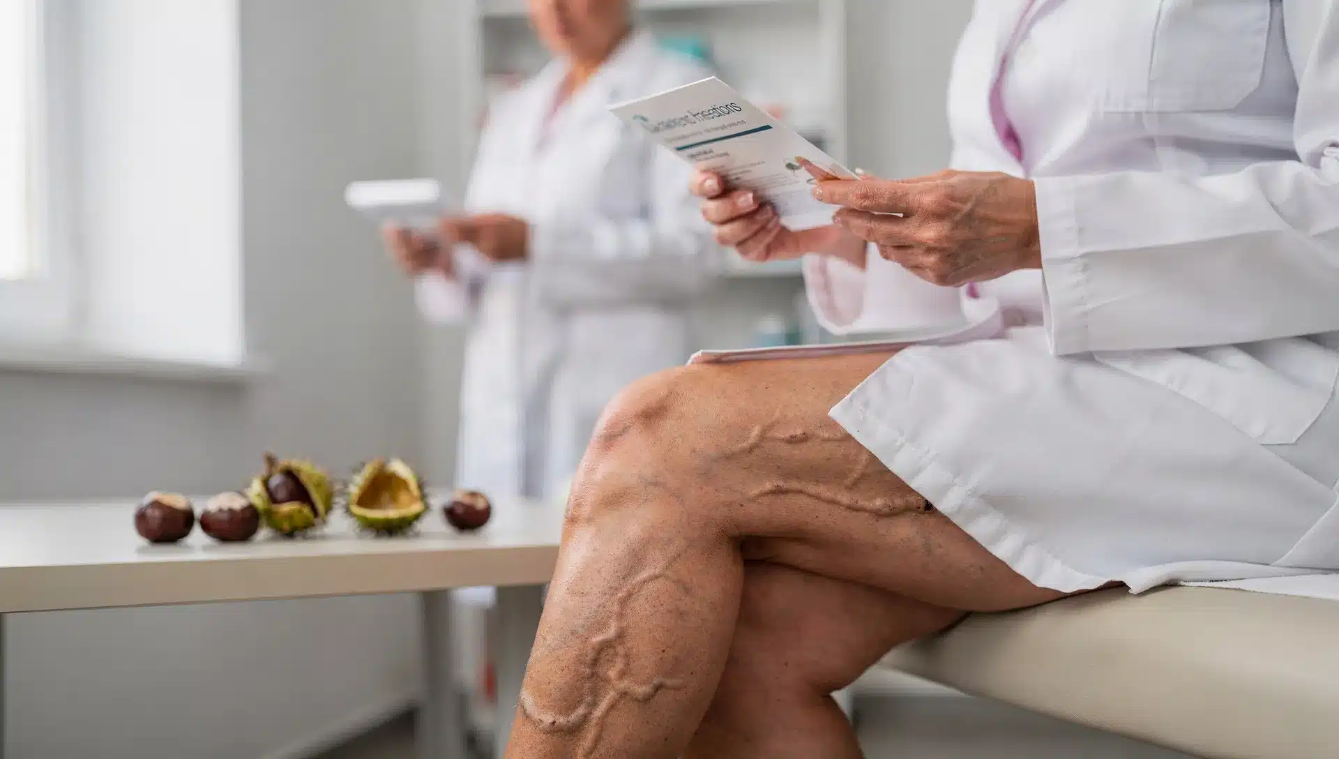 Donna con vene varicose visibili alle gambe in un contesto clinico, con riferimento all'ippocastano come supporto ai sintomi